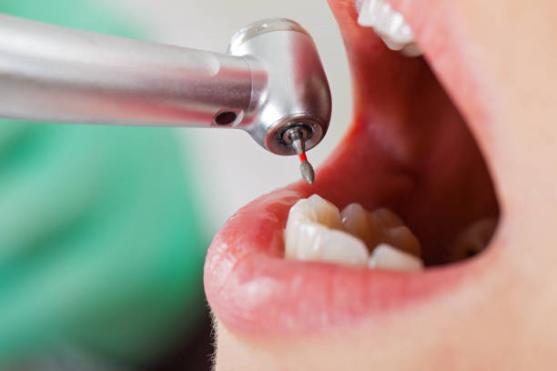 Best Tooth Infection Emergency Dentist  in Evergreen, CO